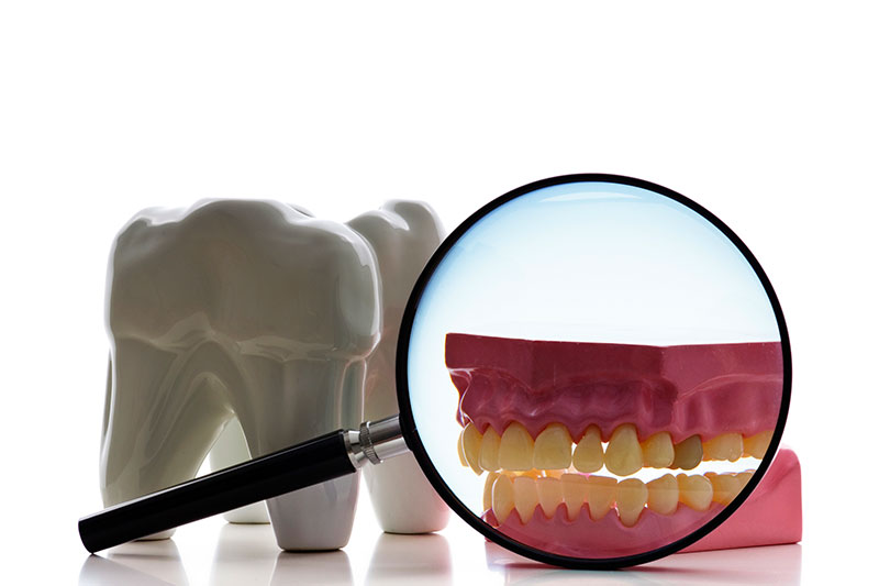Root Canal in Havre de Grace