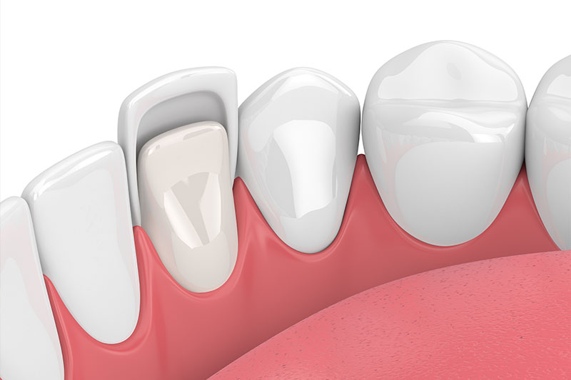 Cosmetic Dentistry in Havre de Grace